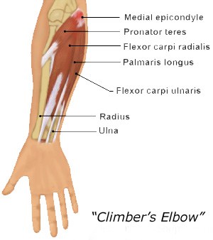 rock climbers elbow